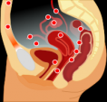 /album/galleria-fotografica/endometriosi-2-png/